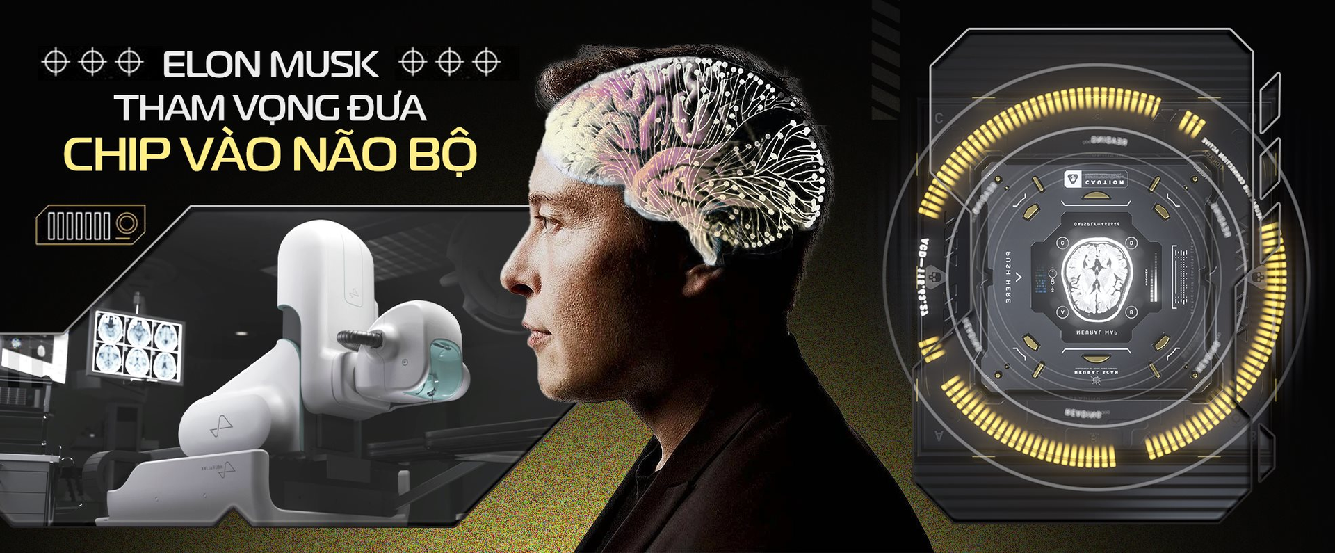 Giấc mơ cấy chip vào não người điên rồ của Elon Musk: Tự chế tạo robot phẫu thuật, sẽ thực hiện hơn 22.000 cuộc giải phẫu vào năm 2030, chi phí mỗi ca 10.000 USD - Ảnh 2.