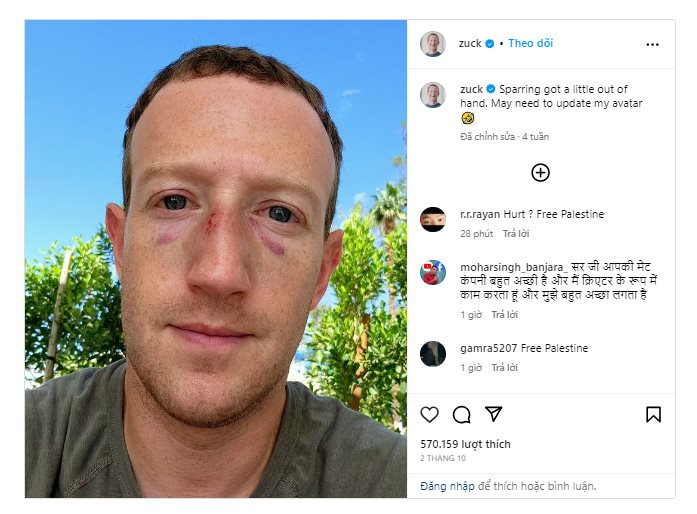 Mark Zuckerberg ‘đánh nhau’ đến nhập viện - Ảnh 3.