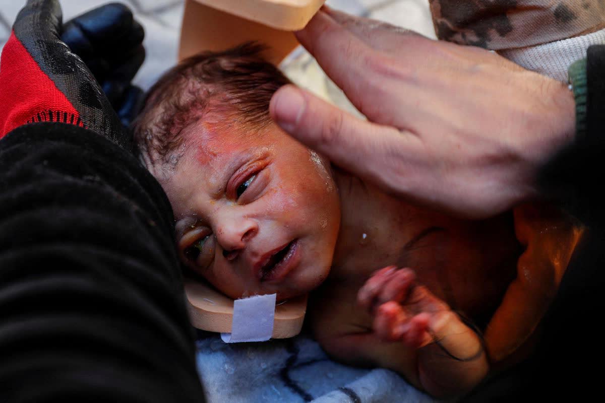 Rất nhiều em bé sơ sinh và trẻ nhỏ sống sót thần kỳ sau nhiều ngày kẹt dưới đống đổ nát, thắp lên hy vọng giữa thảm kịch động đất ở Thổ Nhĩ Kỳ - Syria - Ảnh 1.