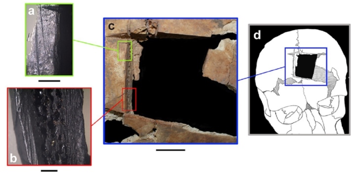 Bí ẩn ca phẫu thuật khoan hộp sọ cách đây 3.500 năm - Ảnh 1.