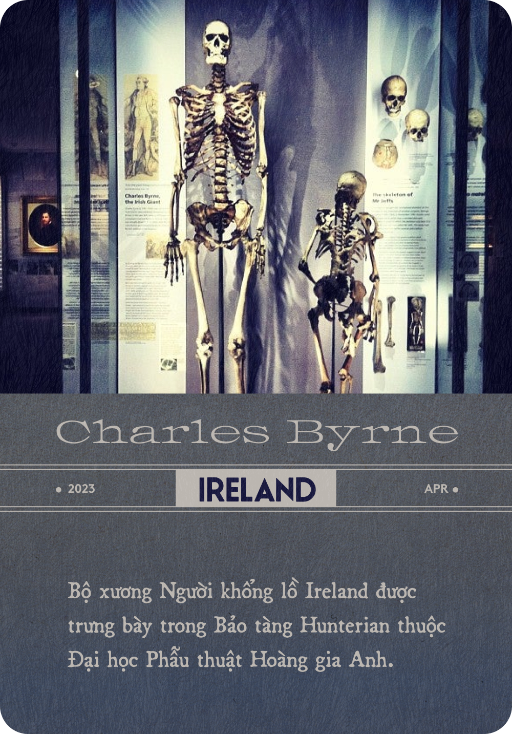 Bộ xương Người khổng lồ Ireland: Tấn bi kịch gây tranh cãi nhất ...