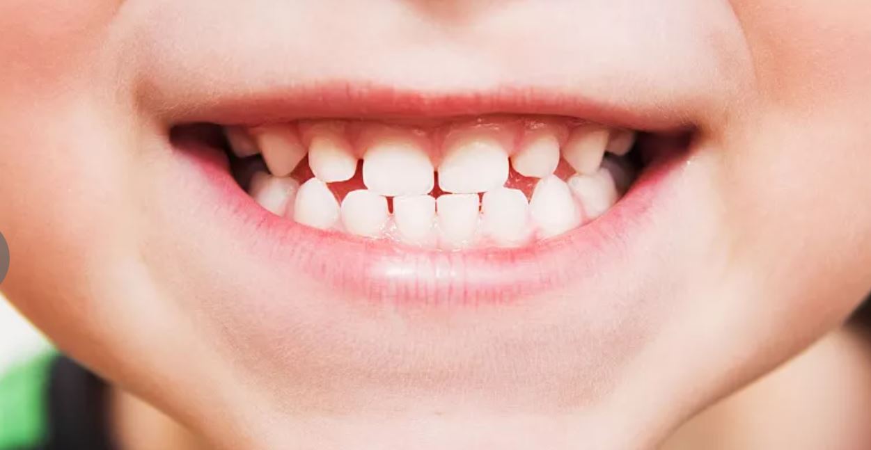 Phát triển loại thuốc giúp răng mọc lại nhiều lần - Ảnh 1.