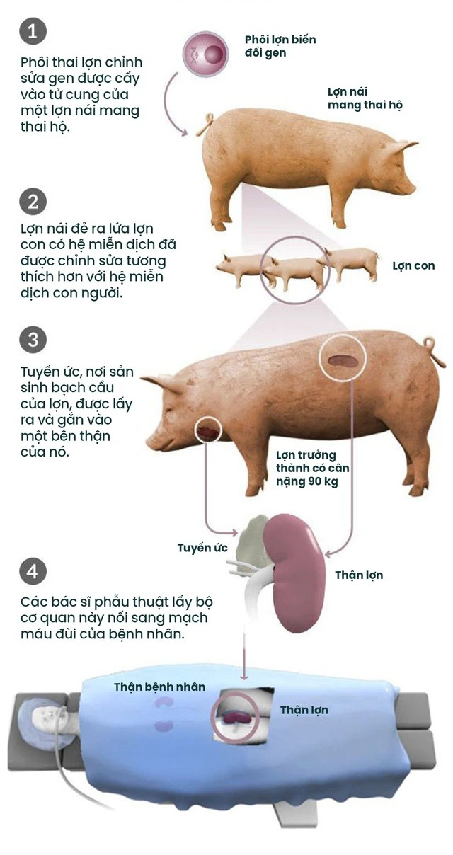 Đột phá: Các bác sĩ Mỹ ghép thận lợn sang người và ước mơ về một nguồn cung nội tạng vô tận - Ảnh 7.