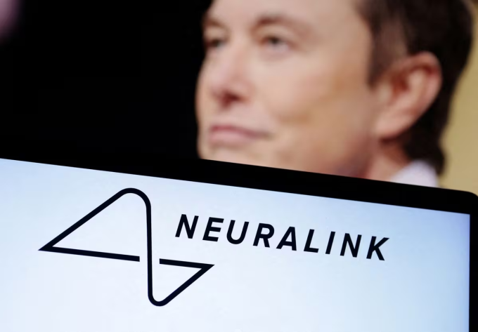 Neuralink của Elon Musk lần đầu tiên cấy chip não lên người- Ảnh 1.