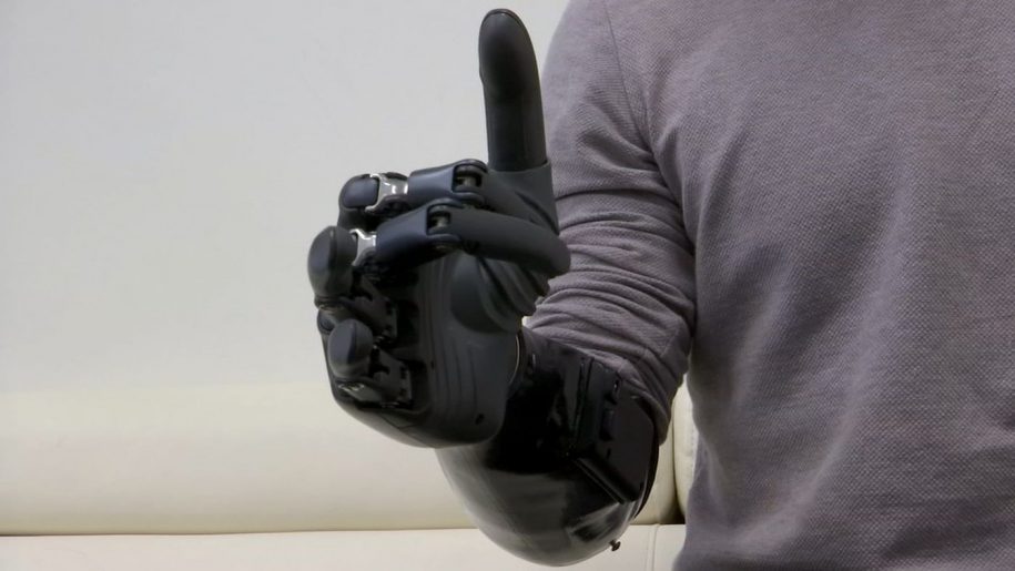 Cánh tay robot giúp người khuyết tật tự sinh hoạt- Ảnh 2.