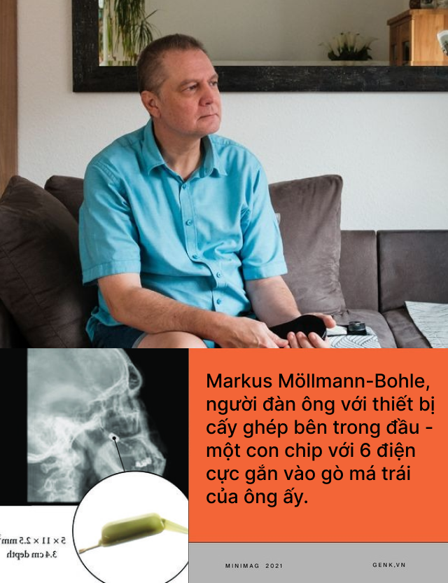 Công nghệ đã cứu rỗi những người khuyết tật này, nhưng bây giờ, chính công nghệ lại đang bỏ rơi họ- Ảnh 1.