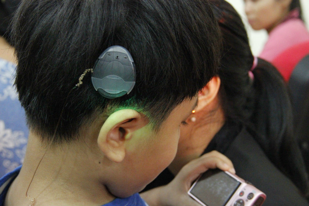 Đột phá: Trung Quốc thử nghiệm liệu pháp gen, chữa bệnh câm điếc bẩm sinh chỉ bằng một mũi tiêm- Ảnh 6.