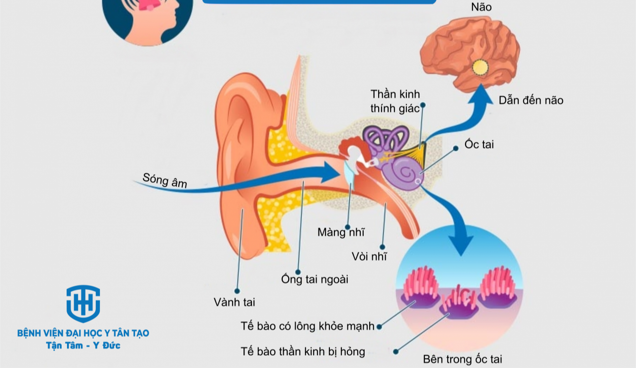 Tết hát karaoke quá 1 tiếng/ngày có thể khiến cả nhà bị tòe lông ốc tai, hiện chưa có thuốc chữa- Ảnh 1.