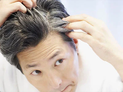 Nghiên cứu của ĐH Harvard làm rõ mối quan hệ giữa tóc bạc và bệnh ung thư: Thực hư ra sao?- Ảnh 2.