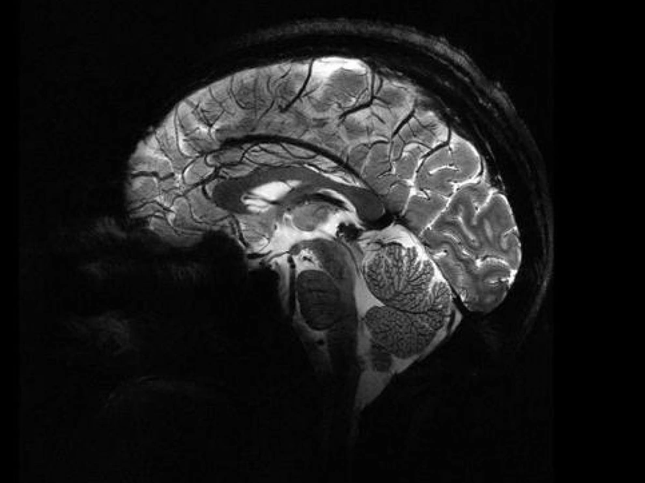 Hình ảnh rõ nét nhất về bộ não chúng ta từ siêu máy quét MRI- Ảnh 1.