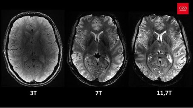 Hình ảnh rõ nét nhất về bộ não chúng ta từ siêu máy quét MRI- Ảnh 2.