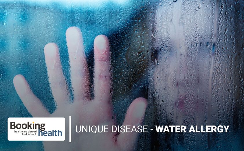 Không tắm, không rửa tay, không đổ mồ hôi và không được khóc: Cuộc sống của những bệnh nhân dị ứng với nước- Ảnh 1.