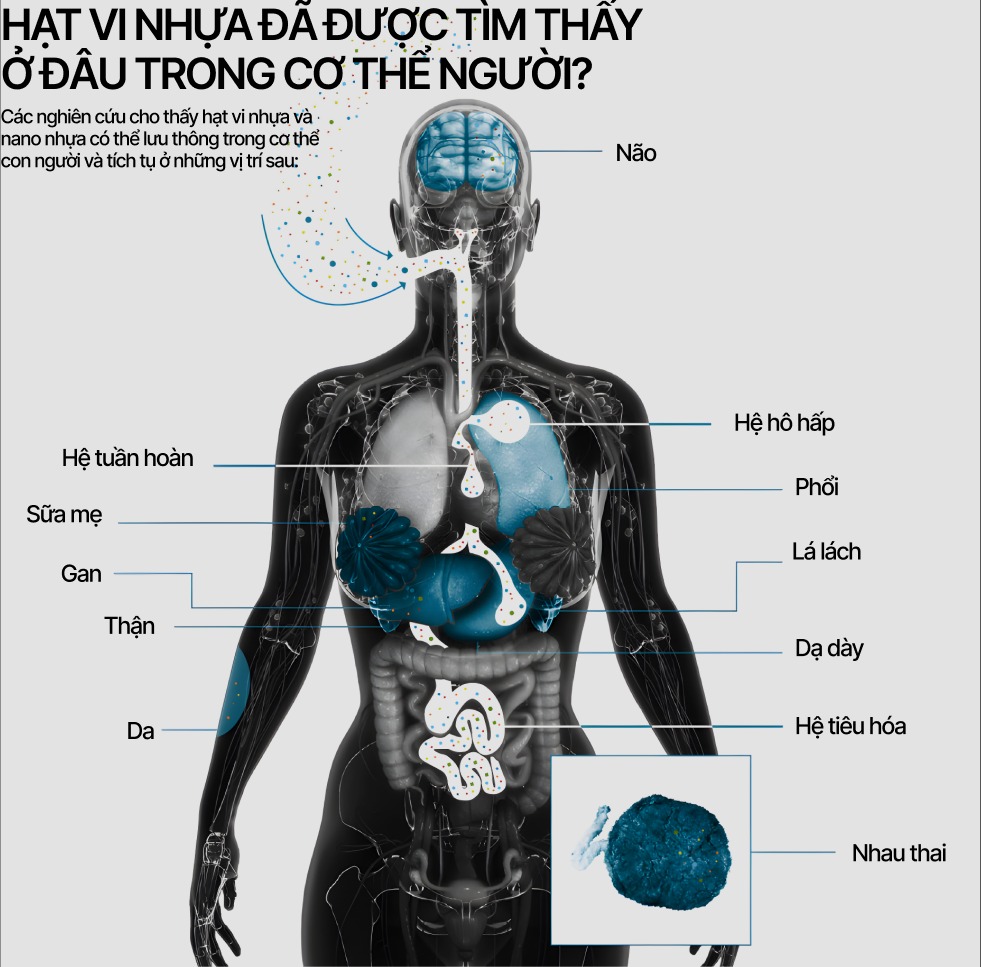 Đúng 20 năm về trước, hạt vi nhựa đầu tiên được phát hiện, hơn 7.000 nghiên cứu đã được thực hiện kể từ đó, kết quả chỉ ra điều gì?- Ảnh 5.