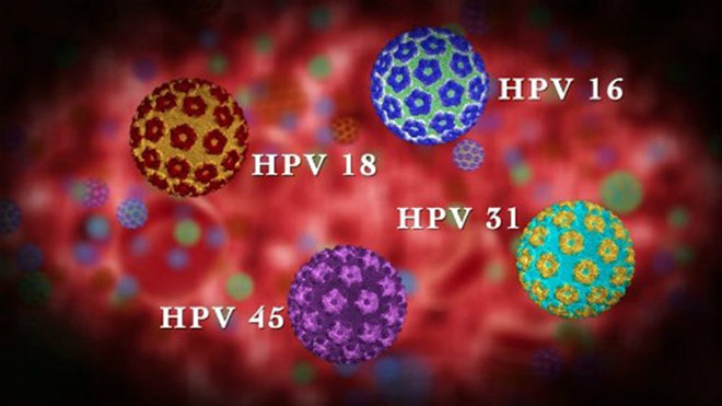 Người đàn ông bất ngờ phát hiện mắc ung thư ở miệng, vì chủng virus anh nghĩ chỉ lây nhiễm tử cung phụ nữ- Ảnh 4.