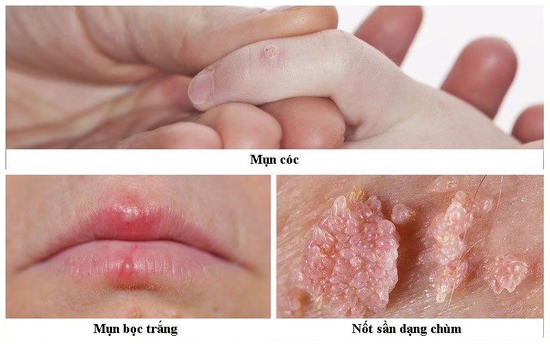 Người đàn ông bất ngờ phát hiện mắc ung thư ở miệng, vì chủng virus anh nghĩ chỉ lây nhiễm tử cung phụ nữ- Ảnh 5.