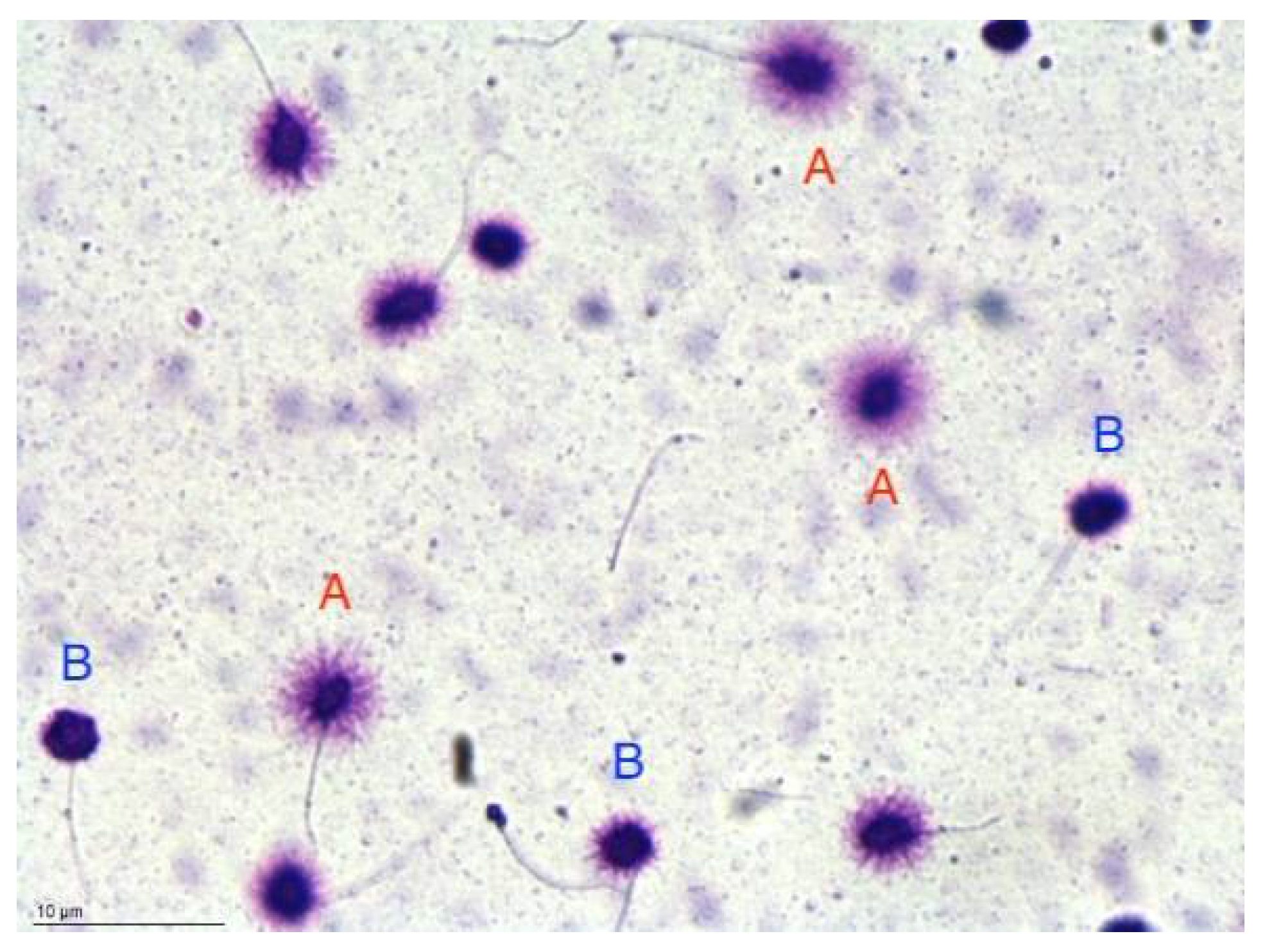 Người đàn ông bất ngờ phát hiện mắc ung thư ở miệng, vì chủng virus anh nghĩ chỉ lây nhiễm tử cung phụ nữ- Ảnh 8.