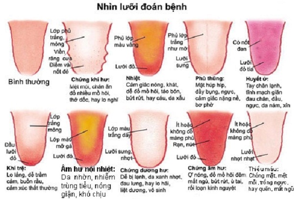 Cỗ máy có thể nhìn lưỡi đoán bệnh chính xác tới 98%: 1.500 năm phát triển của Đông y được gói vào trong một thuật toán AI duy nhất- Ảnh 3.