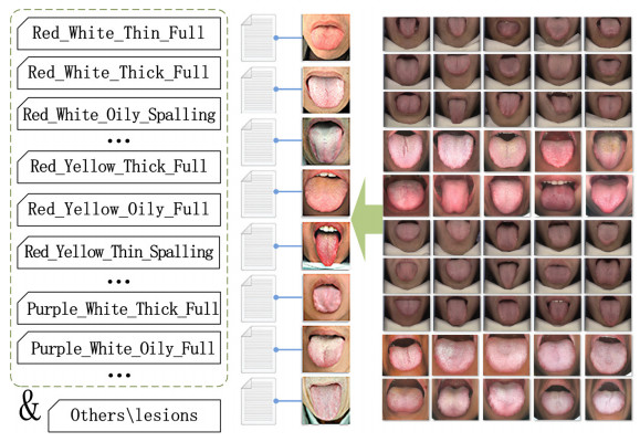 Cỗ máy có thể nhìn lưỡi đoán bệnh chính xác tới 98%: 1.500 năm phát triển của Đông y được gói vào trong một thuật toán AI duy nhất- Ảnh 13.