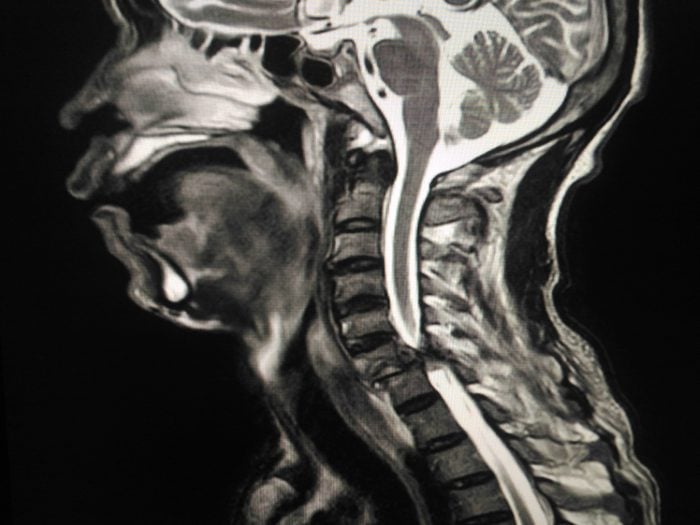 spine-brain-scan.jpg