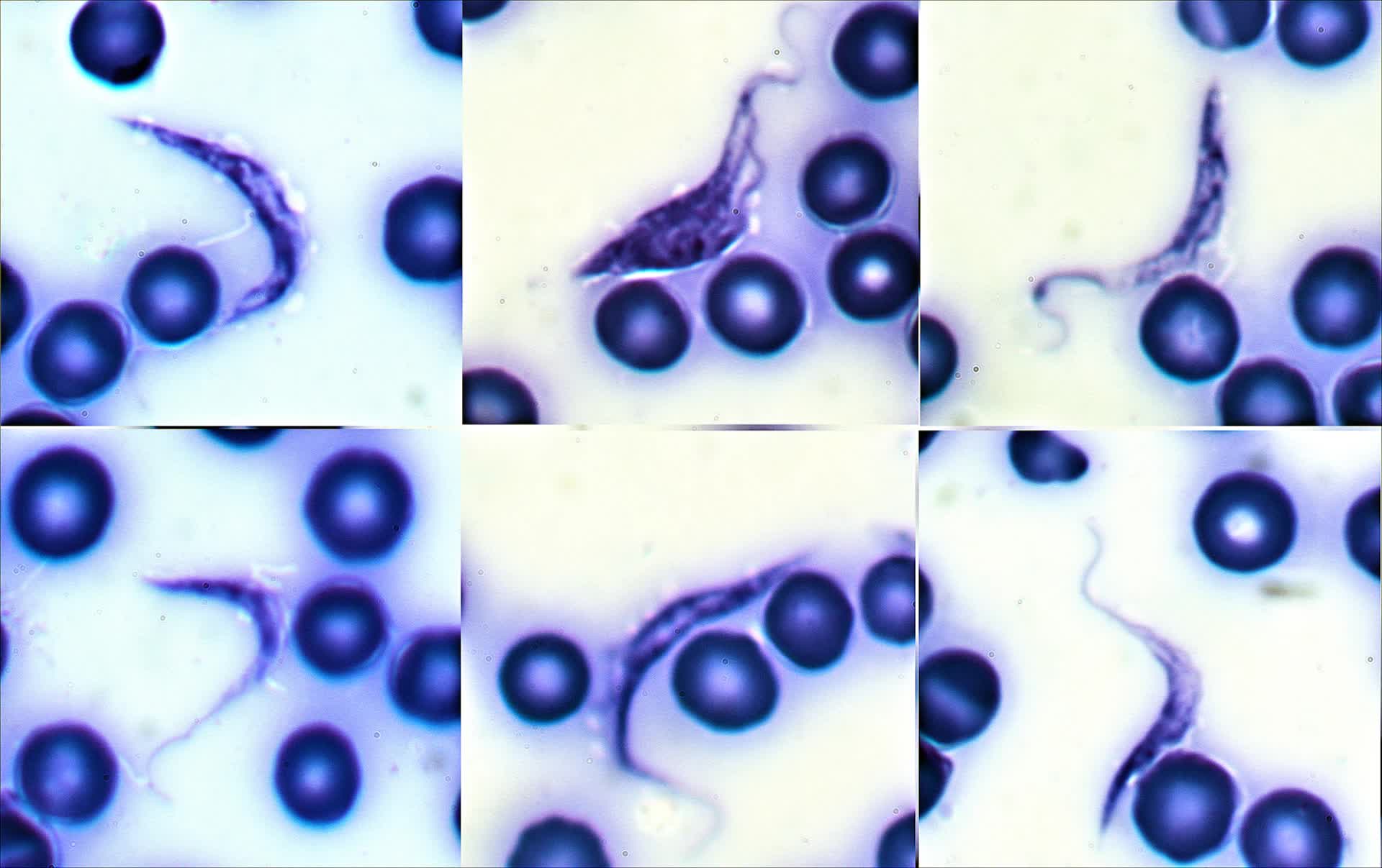 Bệnh Chagas: Mối đe dọa thầm lặng đang len lỏi vào nhà ở và chuồng chó- Ảnh 3. Bệnh Chagas: Mối đe dọa thầm lặng đang len lỏi vào nhà ở và chuồng chó- Ảnh 3.