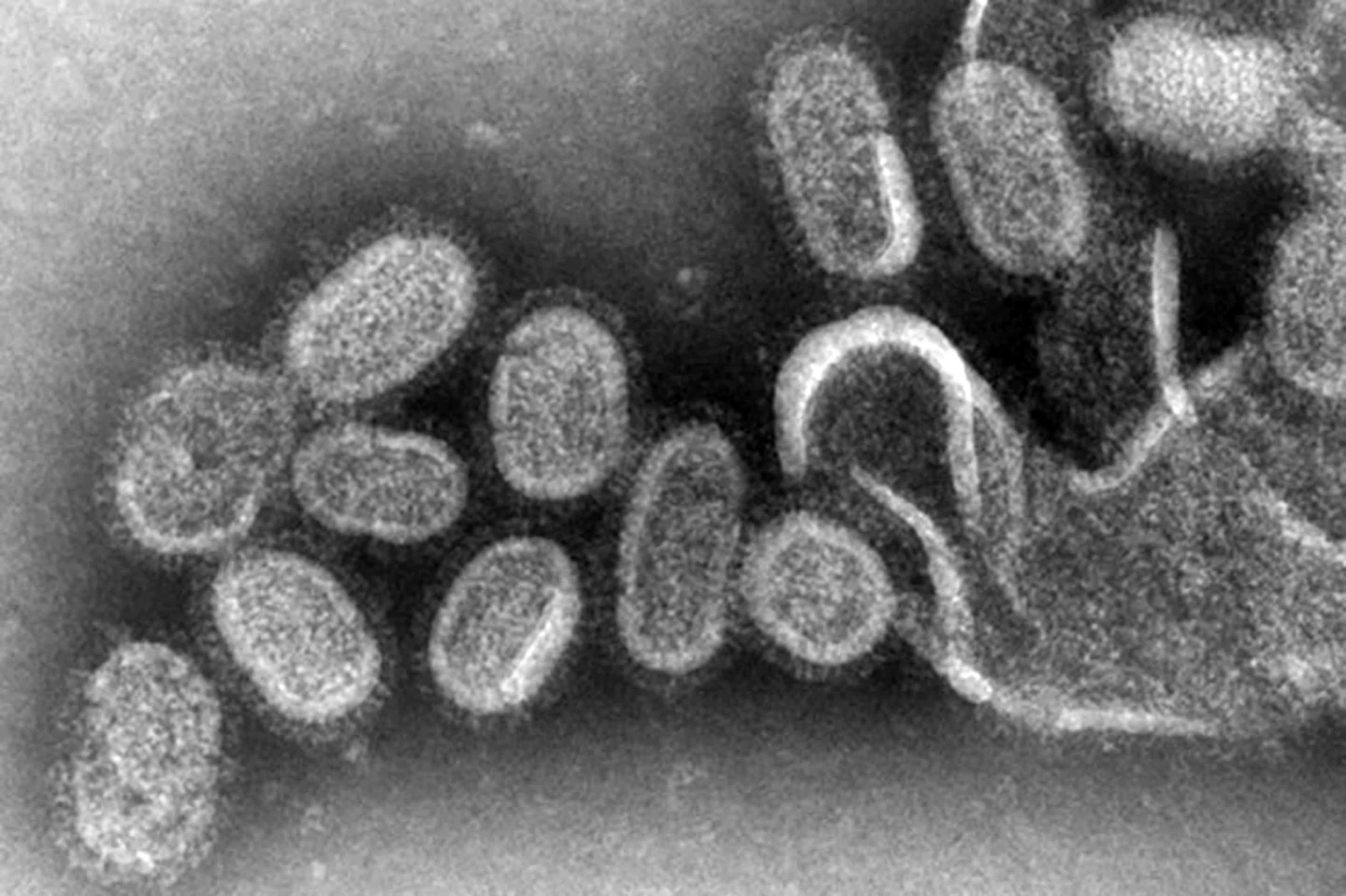 'Dấu chân tử thần': Dấu vết của tế bào chết giúp virus lây lan như thế nào?- Ảnh 3. 'Dấu chân tử thần': Dấu vết của tế bào chết giúp virus lây lan như thế nào?- Ảnh 3.