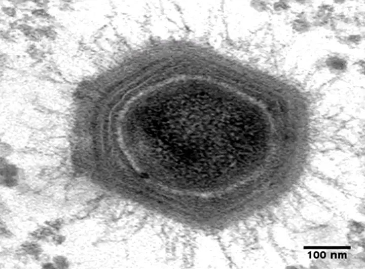 Virus có phải là sinh vật sống không? Tranh cãi kéo dài hàng thập kỷ và những khám phá mới đang thay đổi câu trả lời- Ảnh 1.