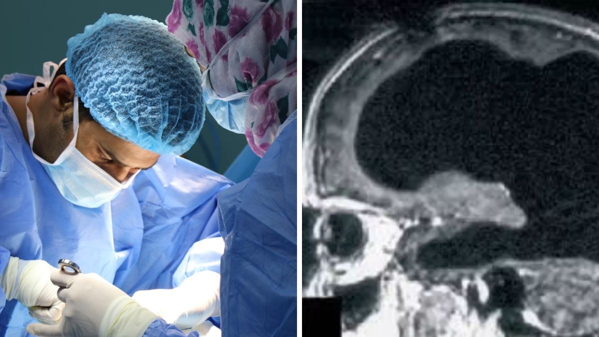 Bí ẩn về người đàn ông mất 90% não, nhưng vẫn có thể sống một cuộc sống bình thường- Ảnh 3. Bí ẩn về người đàn ông mất 90% não, nhưng vẫn có thể sống một cuộc sống bình thường- Ảnh 3.