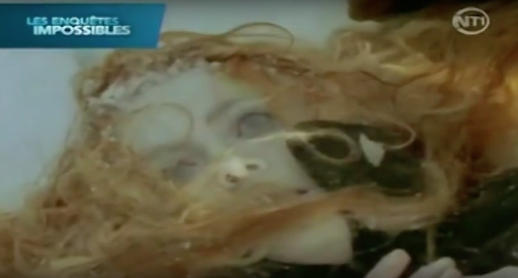 Bị đông cứng như băng suốt 6 giờ ở -30 độ C, người phụ nữ này đã bất ngờ sống lại như trong phim- Ảnh 4. Bị đông cứng như băng suốt 6 giờ ở -30 độ C, người phụ nữ này đã bất ngờ sống lại như trong phim- Ảnh 4.