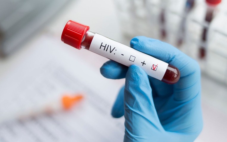 Đi kh&aacute;m sức khỏe định kỳ, nam shipper 35 tuổi ph&aacute;t hiện nhiễm HIV: Cho&aacute;ng v&aacute;ng khi biết nguồn l&acirc;y - Ảnh 1.