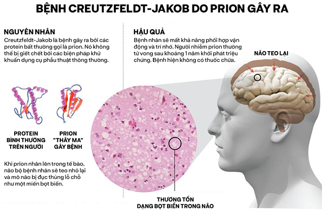 Cảnh giác trước Prion: Một căn bệnh "zombie" có khả năng lây nhiễm loài người- Ảnh 6.