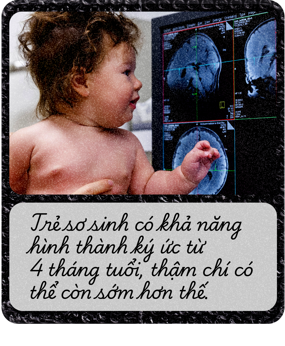 Tại sao chúng ta quên hầu hết ký ức thời thơ ấu: Đó là món quà hay cái giá phải trả của sự trưởng thành?- Ảnh 14. Tại sao chúng ta quên hầu hết ký ức thời thơ ấu: Đó là món quà hay cái giá phải trả của sự trưởng thành?- Ảnh 14.