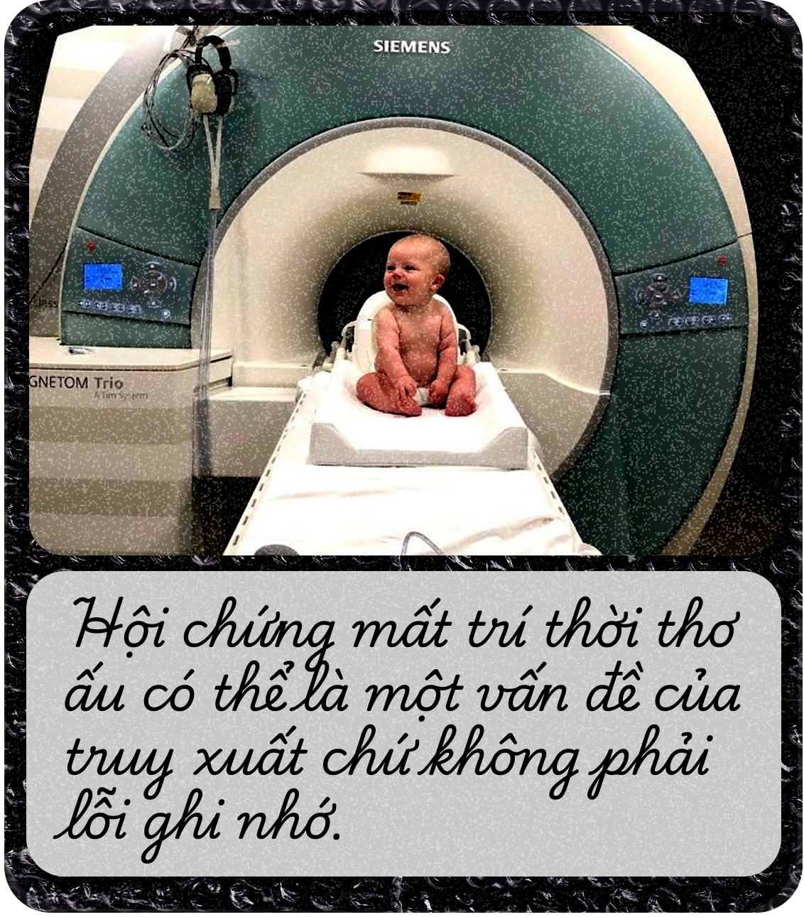 Tại sao chúng ta quên hầu hết ký ức thời thơ ấu: Đó là món quà hay cái giá phải trả của sự trưởng thành?- Ảnh 15. Tại sao chúng ta quên hầu hết ký ức thời thơ ấu: Đó là món quà hay cái giá phải trả của sự trưởng thành?- Ảnh 15.