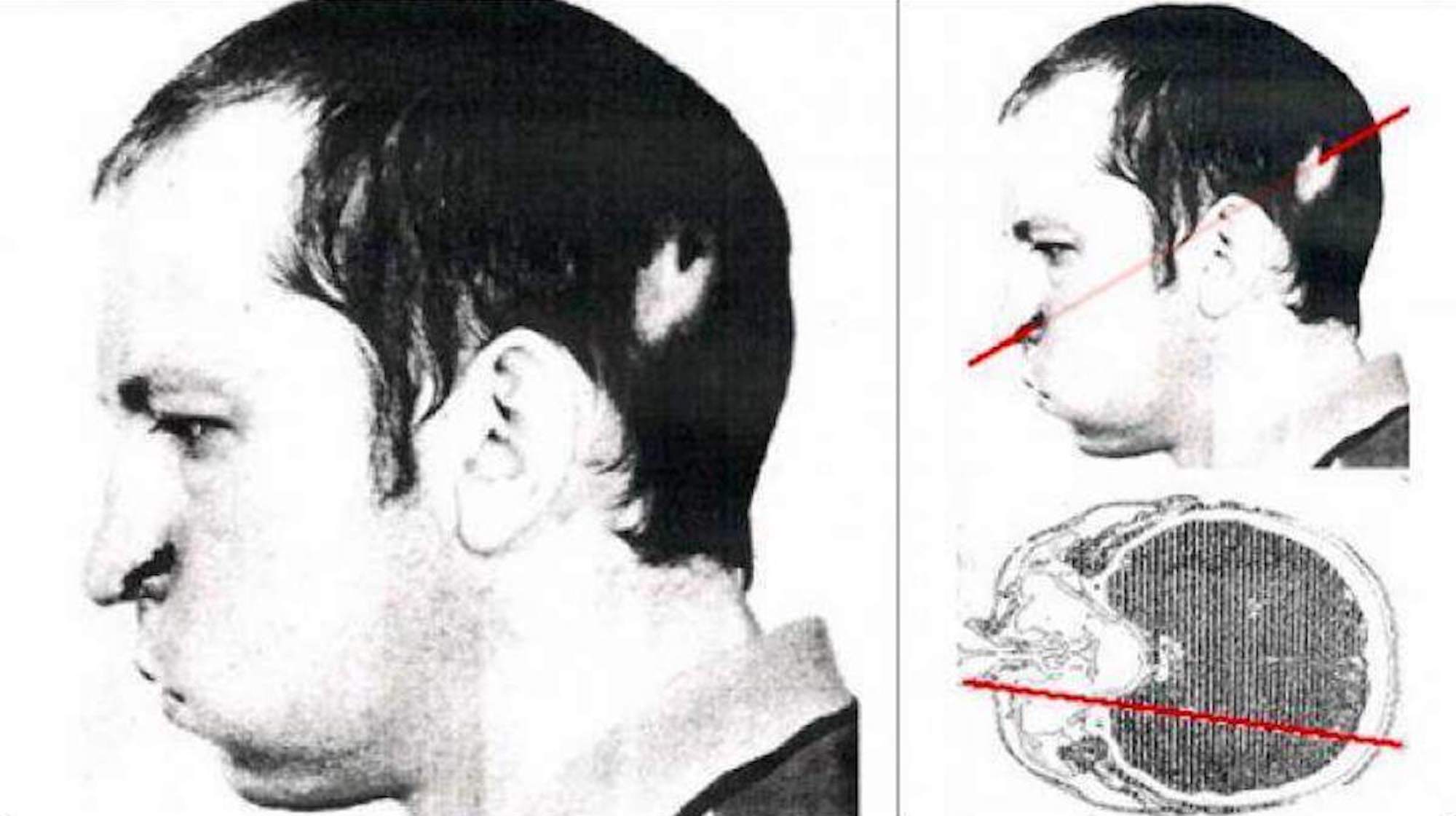 Lần đầu tiên, các nhà khoa học bắn được tia laser xuyên qua đầu một người đàn ông, và ông ấy vẫn còn sống- Ảnh 2. Lần đầu tiên, các nhà khoa học bắn được tia laser xuyên qua đầu một người đàn ông, và ông ấy vẫn còn sống- Ảnh 2.