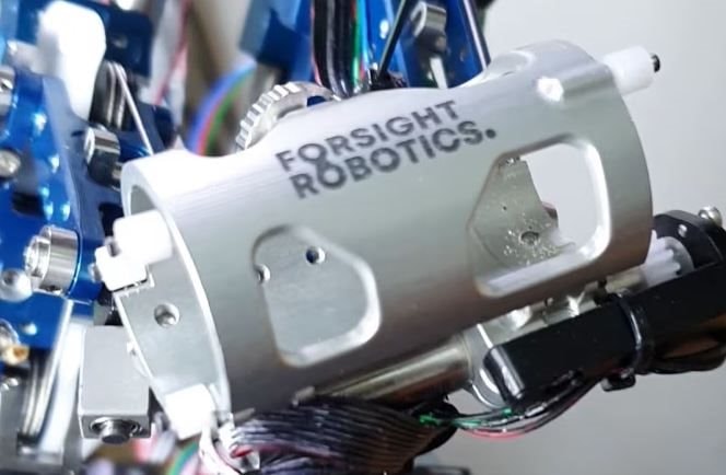 600 triệu bệnh nhân cần phẫu thuật mắt – Một startup đang muốn dùng robot thay bàn tay bác sĩ làm điều này!- Ảnh 2. 600 triệu bệnh nhân cần phẫu thuật mắt – Một startup đang muốn dùng robot thay bàn tay bác sĩ làm điều này!- Ảnh 2.