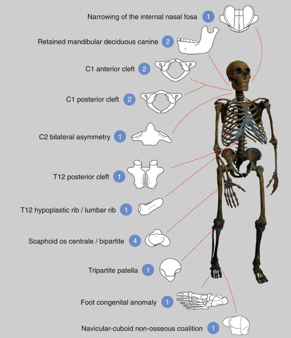 Bí ẩn 'lời nguyền' của người Neanderthal: Hóa thạch 30.000 năm tuổi hé lộ bi kịch tuyệt chủng đầy máu và nước mắt!- Ảnh 2. Bí ẩn 'lời nguyền' của người Neanderthal: Hóa thạch 30.000 năm tuổi hé lộ bi kịch tuyệt chủng đầy máu và nước mắt!- Ảnh 2.