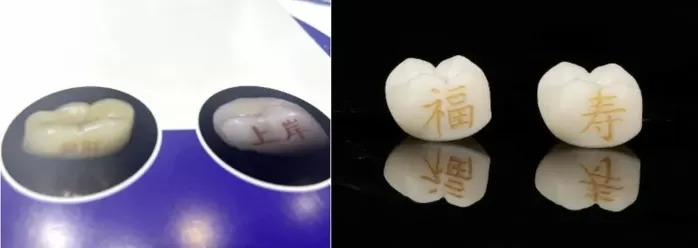 Chán hình xăm trên da, giới trẻ Trung Quốc chuyển sang xăm răng- Ảnh 1.