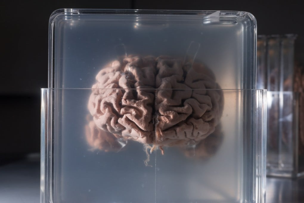 Công nghệ lập bản đồ RNA mới mở ra cơ hội giải mã bộ não Einstein và kho báu di truyền bị lãng quên- Ảnh 1.