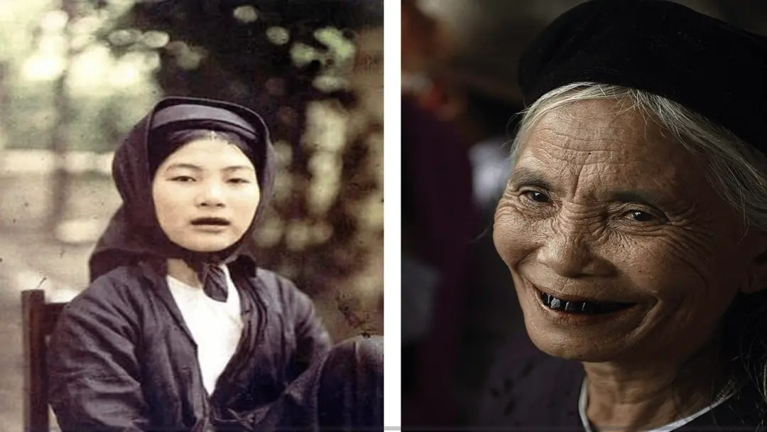 Phát hiện chấn động tại di chỉ Đông Xá: Tục nhuộm răng đen của người Việt đã tồn tại từ 2.000 năm trước - Ảnh 2.