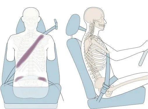 Hội chứng d&acirc;y đai an to&agrave;n v&agrave; những g&oacute;c khuất nguy hiểm &iacute;t người biết từ thiết bị cứu mạng - Ảnh 2.