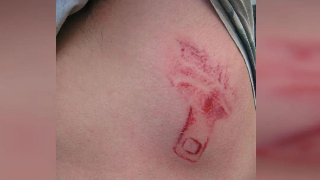 Hội chứng d&acirc;y đai an to&agrave;n v&agrave; những g&oacute;c khuất nguy hiểm &iacute;t người biết từ thiết bị cứu mạng - Ảnh 5.