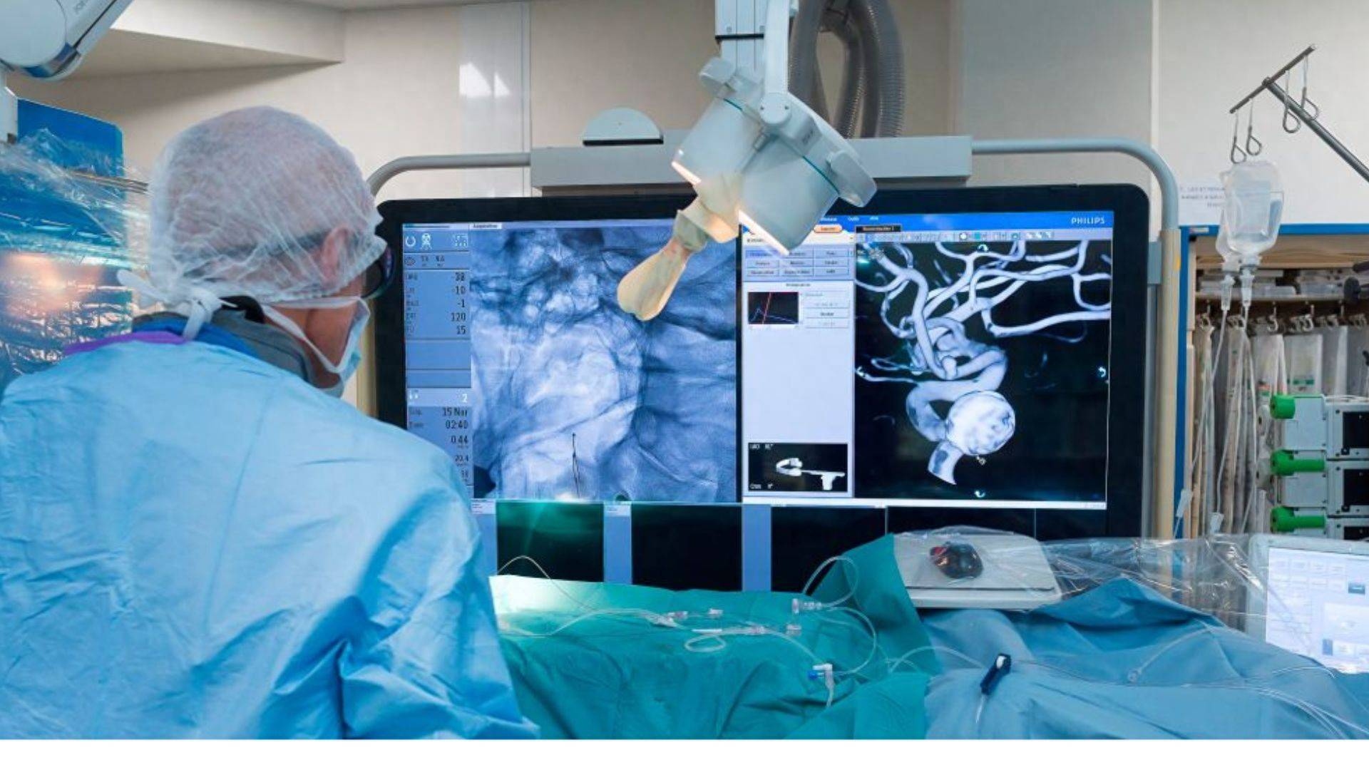 Robot can thiệp mạch m&aacute;u của Trung Quốc đạt 100% th&agrave;nh c&ocirc;ng, r&uacute;t ngắn gần một phần ba thời gian phẫu thuật n&atilde;o - Ảnh 1.