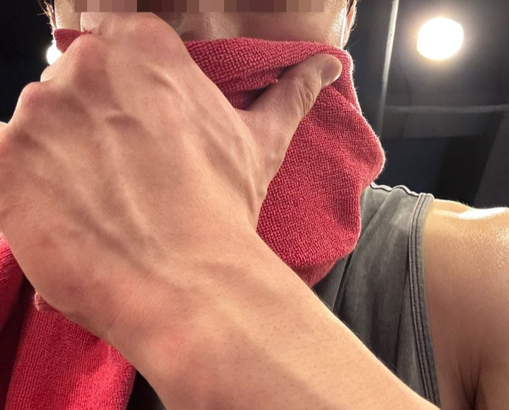 Ch&agrave;ng trai ngo&agrave;i 20 tuổi bị s&ugrave;i m&agrave;o g&agrave; khẳng định chưa từng l&agrave;m "chuyện ấy", b&aacute;c sĩ tiết lộ "b&iacute; mật" từ ph&ograve;ng tập gym - Ảnh 2.