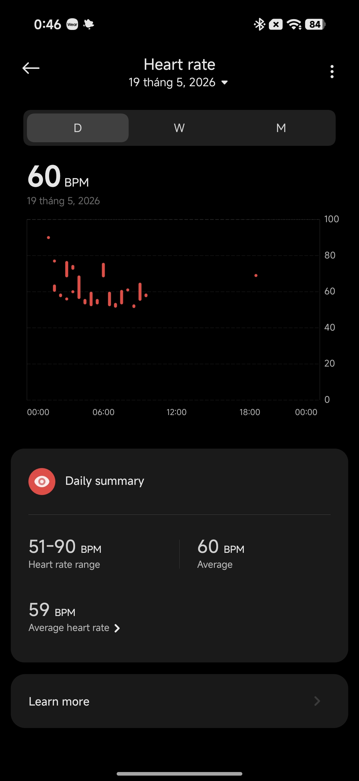 Gallery - Trải nghiệm REDMI Watch 6: Màn hình sáng hơn rõ rệt, pin vẫn “trâu”, đeo thoải mái, HyperOS cơ bản, mua bây giờ được tặng tai nghe - image 11