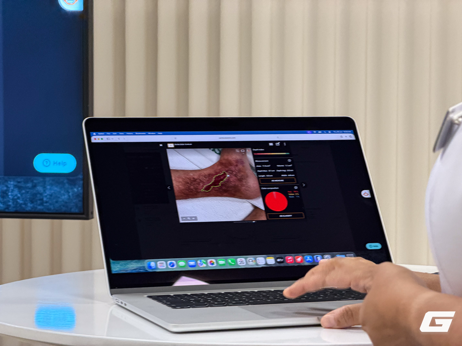 &ldquo;Ch&uacute;ng ta đ&atilde; c&oacute; sẵn một chiếc điện thoại đủ ti&ecirc;u chuẩn&rdquo;: Đ&acirc;y l&agrave; c&aacute;ch hệ thống y tế Singapore biến iPhone th&agrave;nh c&ocirc;ng cụ chăm s&oacute;c vết thương - Ảnh 2.