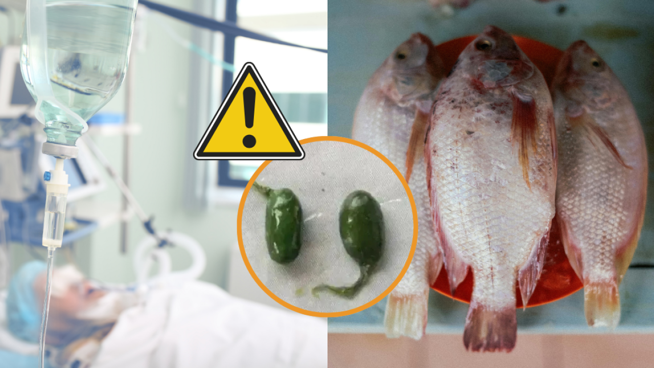 Ăn 1 bộ phận của cá, người phụ nữ suy thận cấp, suy gan: Bác sĩ cảnh báo “nấu chín vẫn nguy hiểm”- Ảnh 1. Ăn 1 bộ phận của cá, người phụ nữ suy thận cấp, suy gan: Bác sĩ cảnh báo “nấu chín vẫn nguy hiểm”- Ảnh 1.