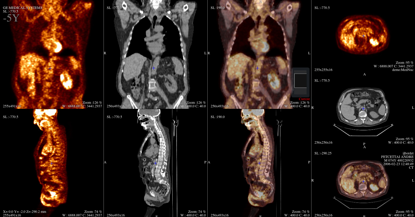 Trung Quốc ra mắt một thiết bị y tế hiện đại nhất thế giới: Máy chụp ...