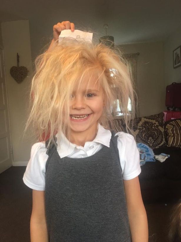 Cô bé 7 tuổi mắc hội chứng tóc rối hệt như búp bê sát nhân trong phim kinh dị - Ảnh 1.