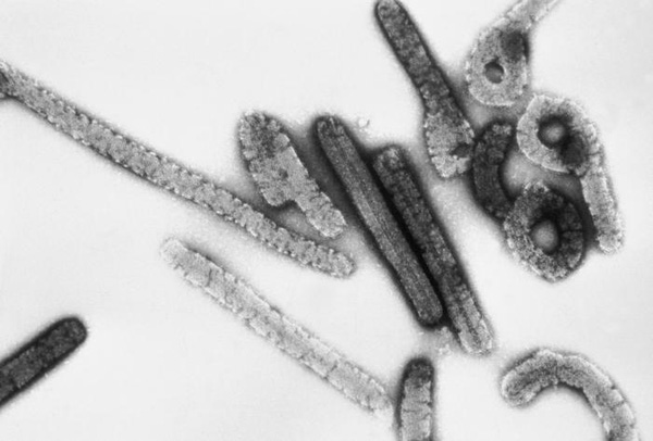  Virus Marburg dưới ống kinh hiển vi. 