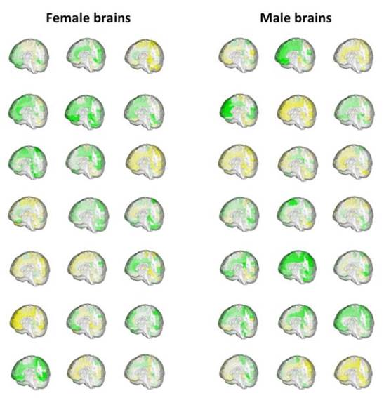  Liệu não bộ nam giới và nữ giới có khác nhau hoàn toàn? 