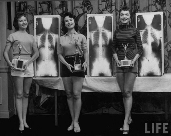  Cuộc thi hoa hậu Tư thế chuẩn được diễn ra vào năm 1956 thu hút không ít mỹ nữ tham gia. Ban giám khảo sẽ đánh giá thí sinh dựa trên hình chụp X-quang để có cái nhìn chân thực nhất về cơ thể của các người đẹp. 